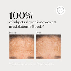 BHA Liquid Exfoliant 2%